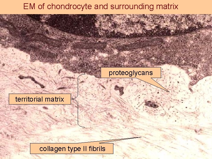 EM of chondrocyte and surrounding matrix proteoglycans territorial matrix collagen type II fibrils 