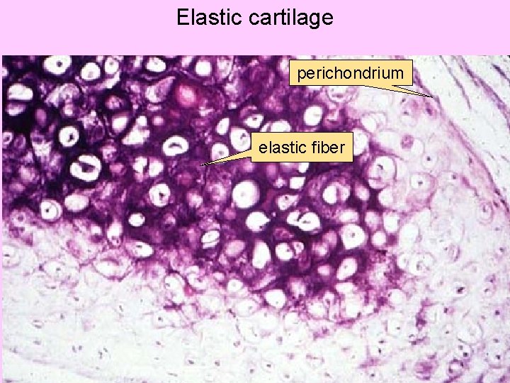 Elastic cartilage perichondrium elastic fiber 