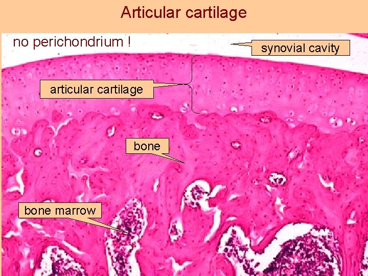 Articular cartilage no perichondrium ! synovial cavity articular cartilage bone marrow 
