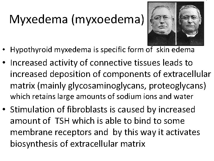 Myxedema (myxoedema) • Hypothyroid myxedema is specific form of skin edema • Increased activity