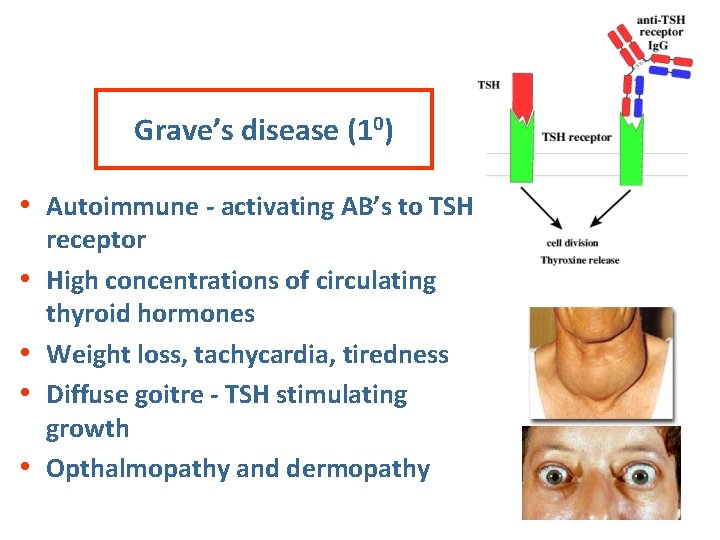 Grave’s disease (10) • Autoimmune - activating AB’s to TSH • • receptor High