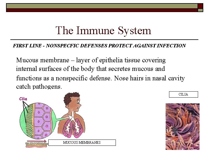 The Immune System FIRST LINE - NONSPECFIC DEFENSES PROTECT AGAINST INFECTION Mucous membrane – The Immune System FIRST LINE - NONSPECFIC DEFENSES PROTECT AGAINST INFECTION Mucous membrane –