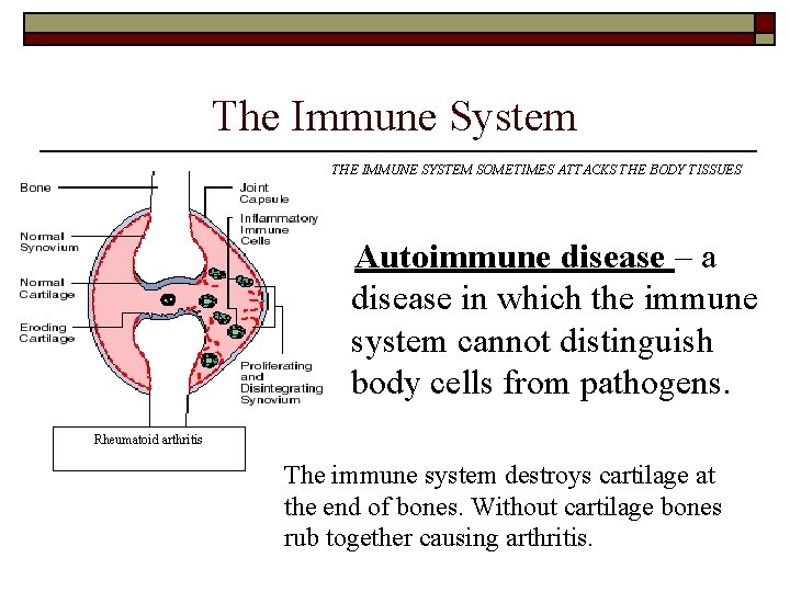 The Immune System THE IMMUNE SYSTEM SOMETIMES ATTACKS THE BODY TISSUES Autoimmune disease – The Immune System THE IMMUNE SYSTEM SOMETIMES ATTACKS THE BODY TISSUES Autoimmune disease –