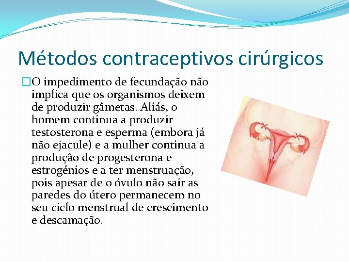 Métodos contraceptivos cirúrgicos �O impedimento de fecundação não implica que os organismos deixem de