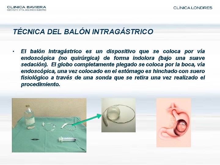 TÉCNICA DEL BALÓN INTRAGÁSTRICO • El balón Intragástrico es un dispositivo que se coloca