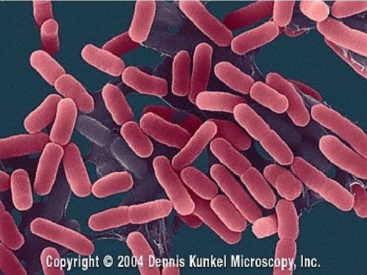 Caption: E. coli 13 