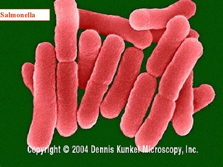 Salmonella [417 ] Caption: Salmonella typhi - Gram-negative, enteric, rod prokaryote (dividing); causes typhoid