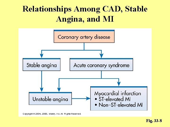 Relationships Among CAD, Stable Angina, and MI Fig. 33 -8 