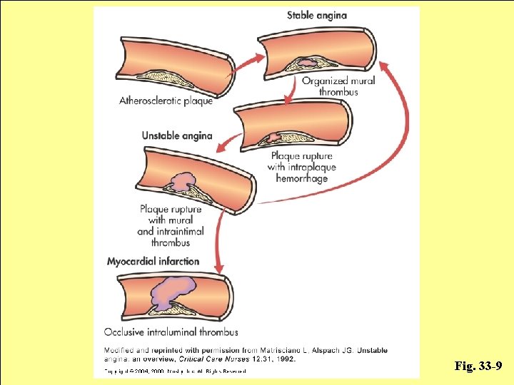 Fig. 33 -9 