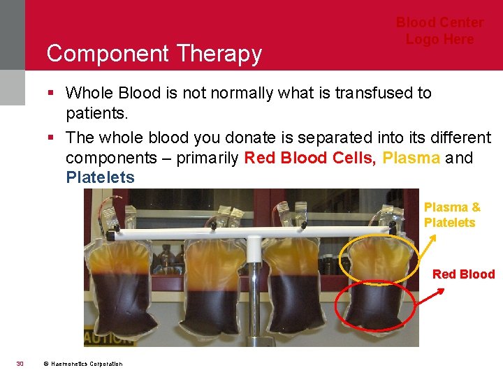 Component Therapy Blood Center Logo Here § Whole Blood is not normally what is