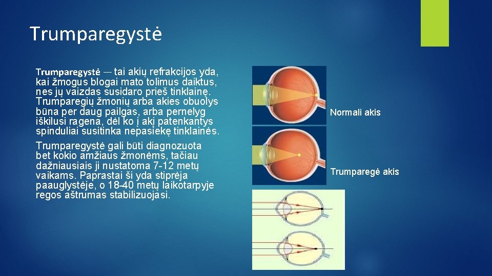 Trumparegystė — tai akių refrakcijos yda, kai žmogus blogai mato tolimus daiktus, nes jų