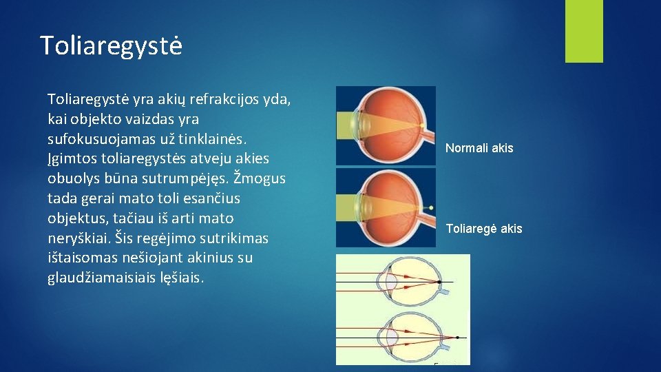 Toliaregystė yra akių refrakcijos yda, kai objekto vaizdas yra sufokusuojamas už tinklainės. Įgimtos toliaregystės