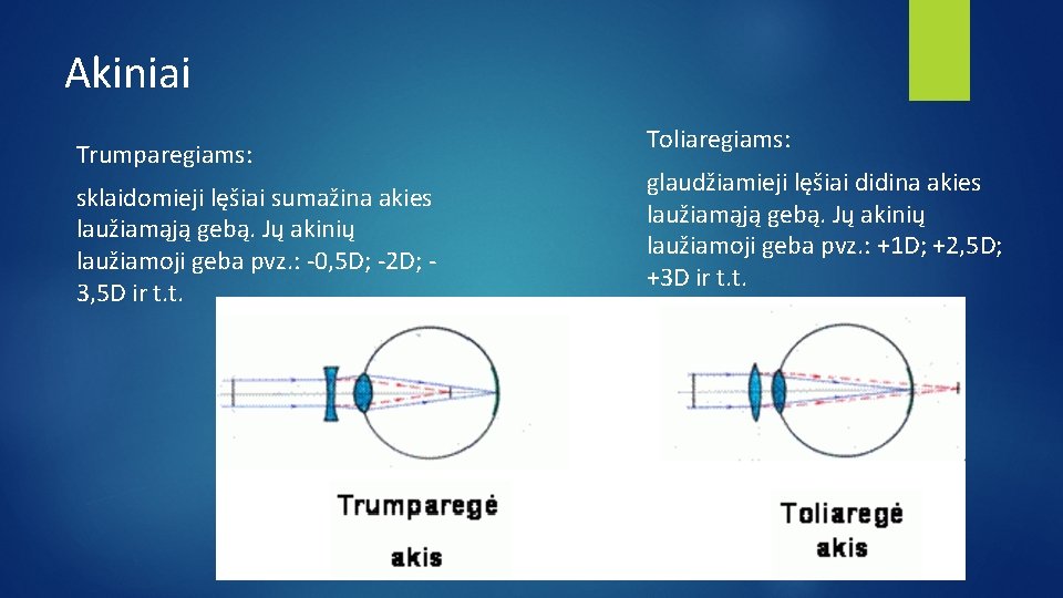Akiniai Trumparegiams: sklaidomieji lęšiai sumažina akies laužiamąją gebą. Jų akinių laužiamoji geba pvz. :