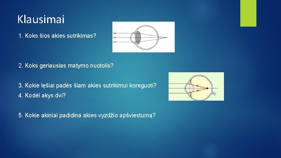 Klausimai 1. Koks šios akies sutrikimas? 2. Koks geriausias matymo nuotolis? 3. Kokie lęšiai