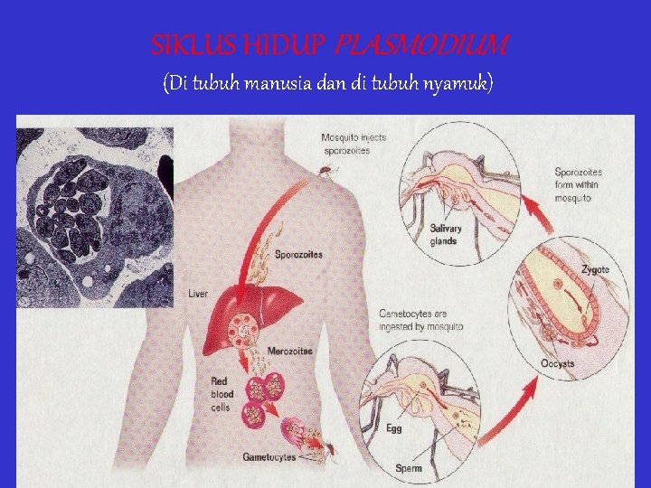 SIKLUS HIDUP PLASMODIUM (Di tubuh manusia dan di tubuh nyamuk) 