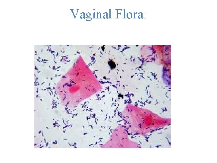 Vaginal Flora:  Vaginal Flora: