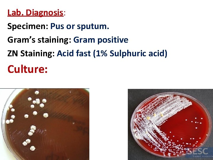 Lab. Diagnosis: Specimen: Pus or sputum. Gram’s staining: Gram positive ZN Staining: Acid fast