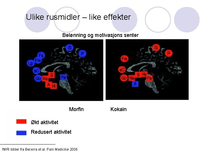 Ulike rusmidler – like effekter Belønning og motivasjons senter Morfin Økt aktivitet Redusert aktivitet