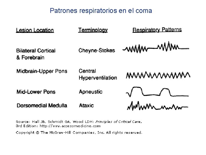 Patrones respiratorios en el coma 