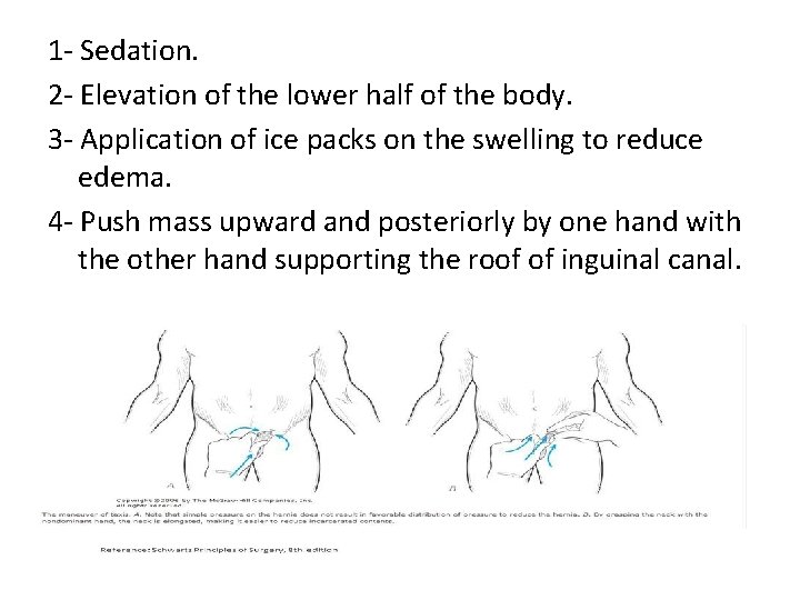 1 - Sedation. 2 - Elevation of the lower half of the body. 3