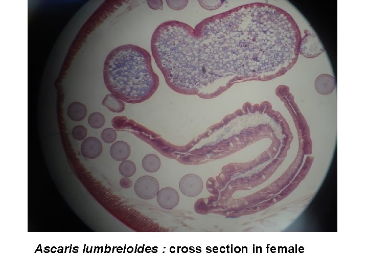 Ascaris lumbreioides : cross section in female 