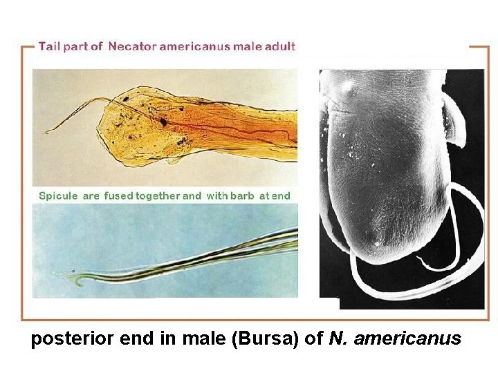 posterior end in male (Bursa) of N. americanus 