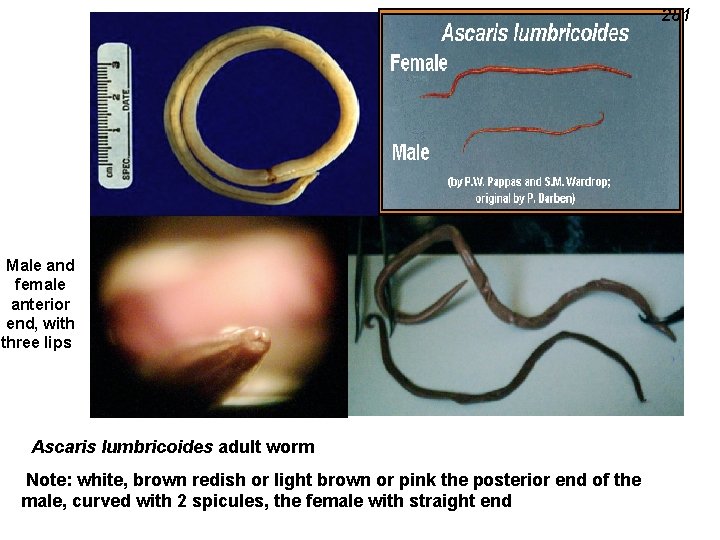 281 Male and female anterior end, with three lips Ascaris lumbricoides adult worm Note: