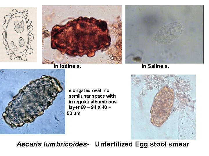 In Iodine s. In Saline s. elongated oval, no semilunar space with irrregular albuminous