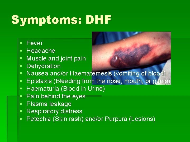 Symptoms: DHF § § § Fever Headache Muscle and joint pain Dehydration Nausea and/or