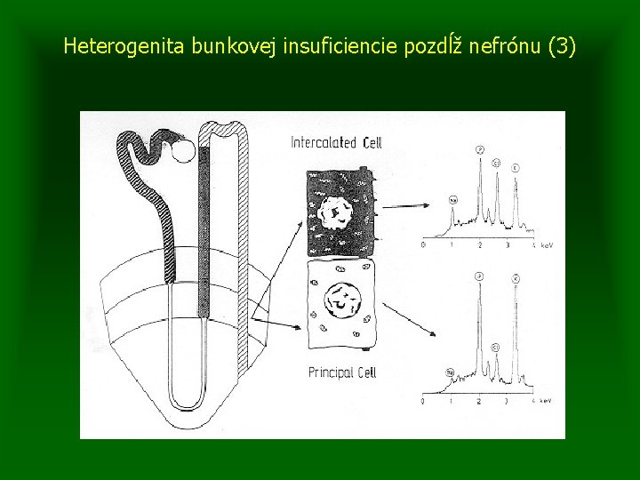 Heterogenita bunkovej insuficiencie pozdĺž nefrónu (3) 