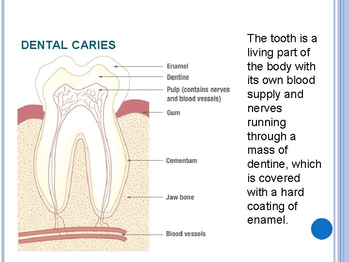 DENTAL CARIES The tooth is a living part of the body with its own