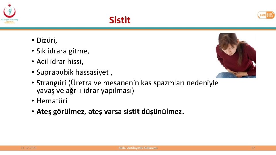 Sistit • Dizüri, • Sık idrara gitme, • Acil idrar hissi, • Suprapubik hassasiyet