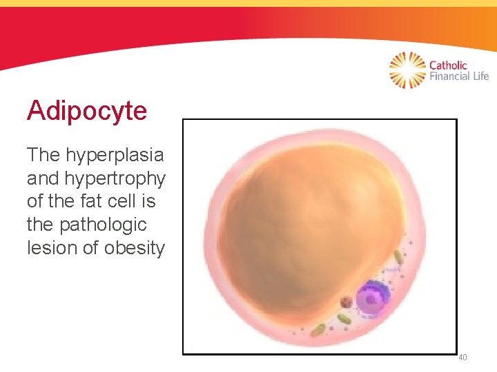 Adipocyte The hyperplasia and hypertrophy of the fat cell is the pathologic lesion of