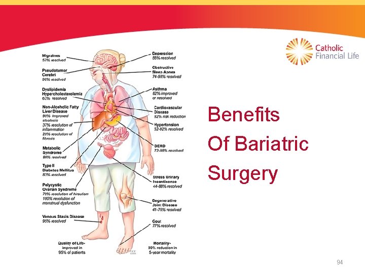 Benefits Of Bariatric Surgery 94 