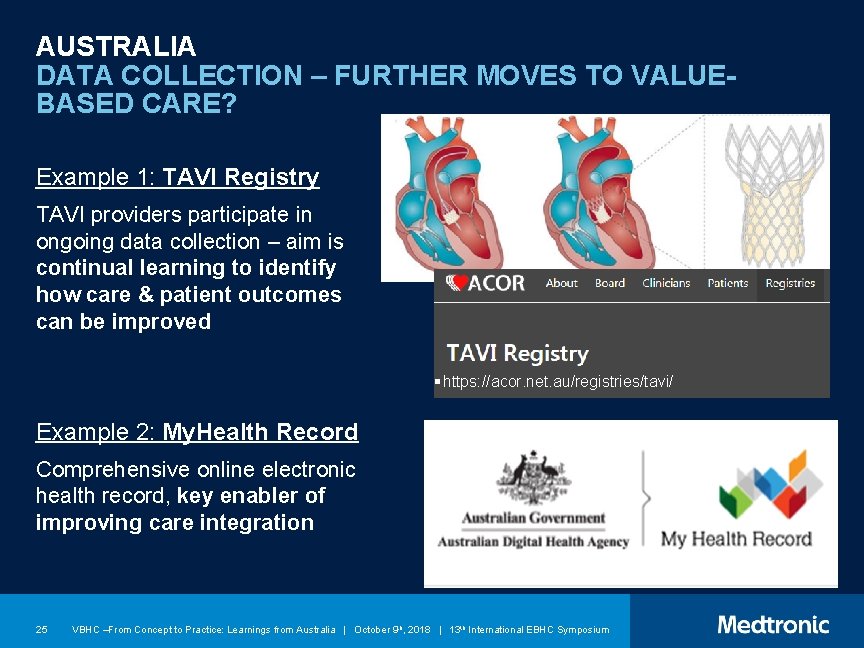 AUSTRALIA DATA COLLECTION – FURTHER MOVES TO VALUEBASED CARE? Example 1: TAVI Registry TAVI