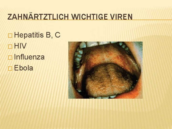 ZAHNÄRTZTLICH WICHTIGE VIREN � Hepatitis � HIV � Influenza � Ebola B, C 