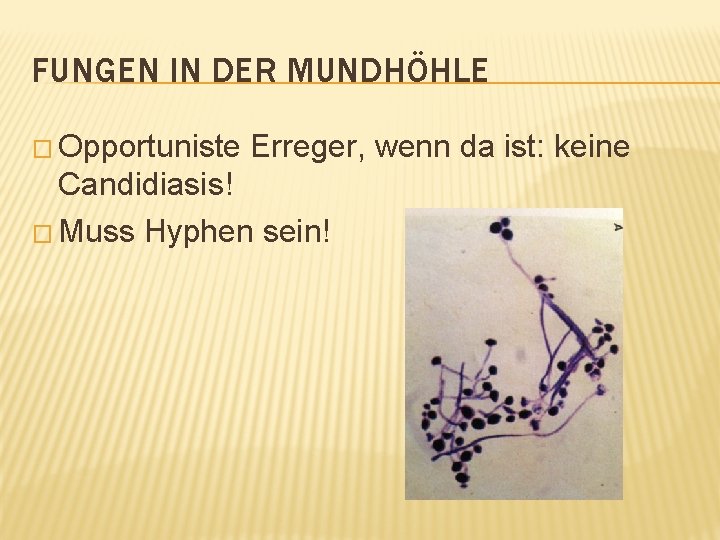 FUNGEN IN DER MUNDHÖHLE � Opportuniste Erreger, wenn da ist: keine Candidiasis! � Muss