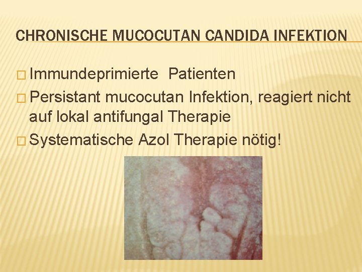CHRONISCHE MUCOCUTAN CANDIDA INFEKTION � Immundeprimierte Patienten � Persistant mucocutan Infektion, reagiert nicht auf