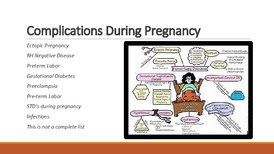 Complications During Pregnancy Ectopic Pregnancy RH Negative Disease Preterm Labor Gestational Diabetes Preeclampsia Pre-term