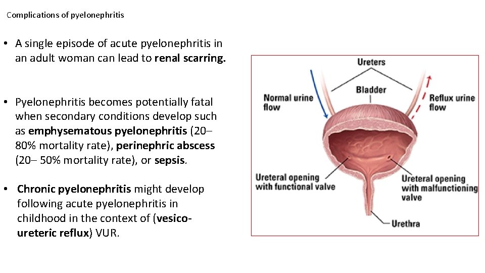 Complications of pyelonephritis • A single episode of acute pyelonephritis in an adult woman Complications of pyelonephritis • A single episode of acute pyelonephritis in an adult woman