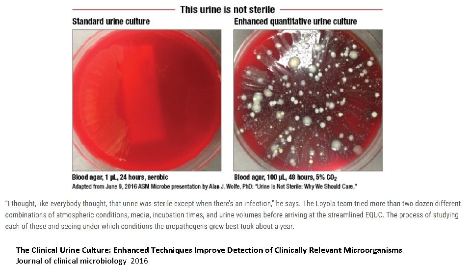 The Clinical Urine Culture: Enhanced Techniques Improve Detection of Clinically Relevant Microorganisms Journal of The Clinical Urine Culture: Enhanced Techniques Improve Detection of Clinically Relevant Microorganisms Journal of