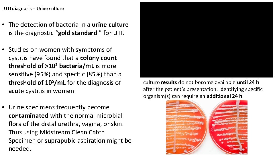 UTI diagnosis – Urine culture • The detection of bacteria in a urine culture UTI diagnosis – Urine culture • The detection of bacteria in a urine culture