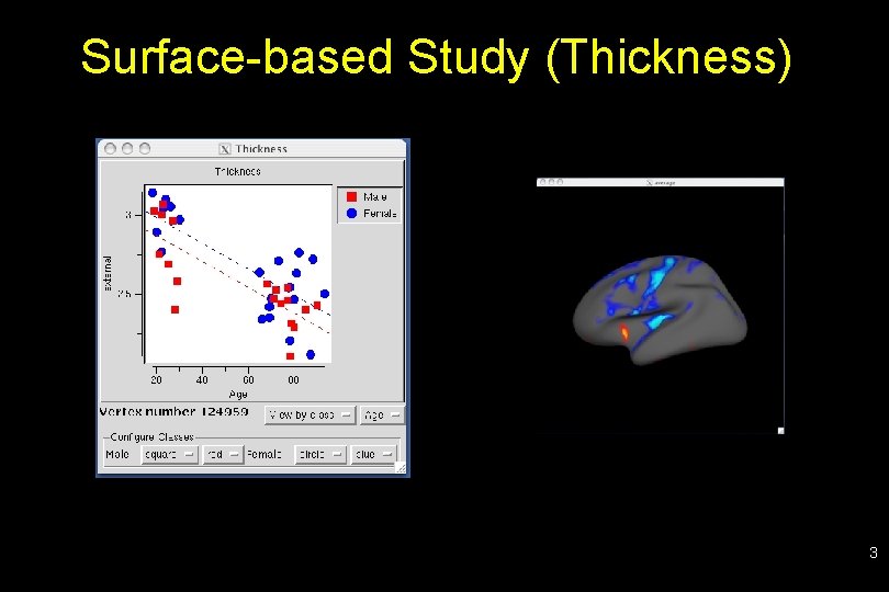 Surface-based Study (Thickness) 3 