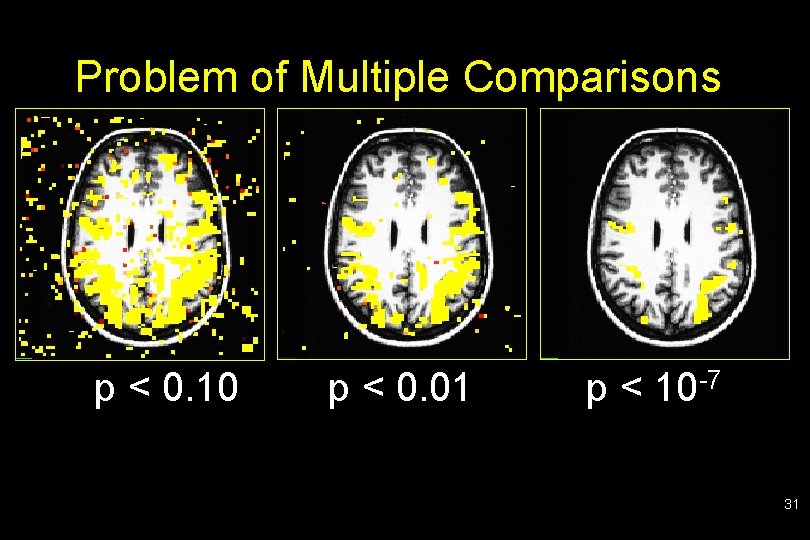 Problem of Multiple Comparisons p < 0. 10 p < 0. 01 p <