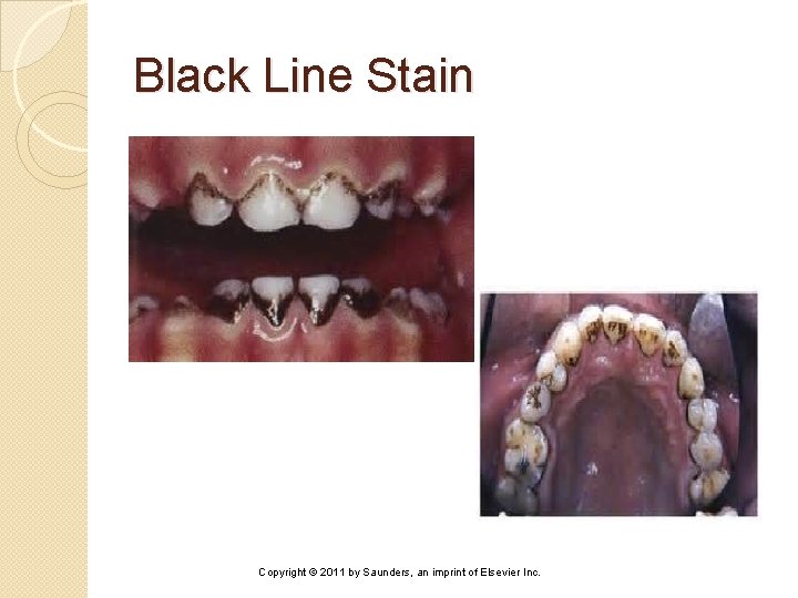 Black Line Stain Copyright © 2011 by Saunders, an imprint of Elsevier Inc. 