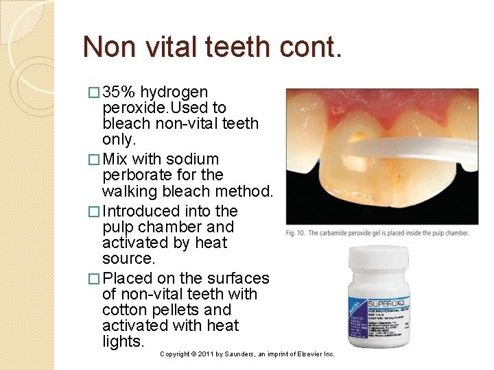 Non vital teeth cont. � 35% hydrogen peroxide. Used to bleach non-vital teeth only.