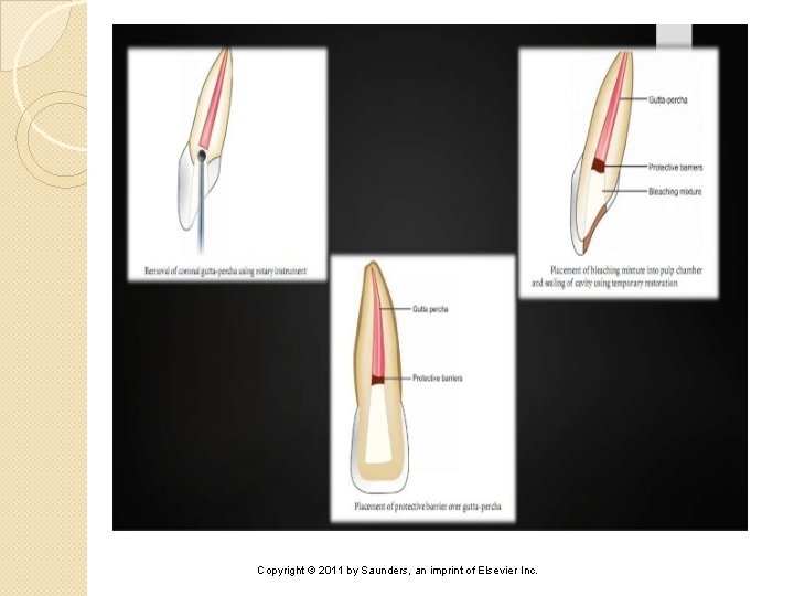 Copyright © 2011 by Saunders, an imprint of Elsevier Inc. 