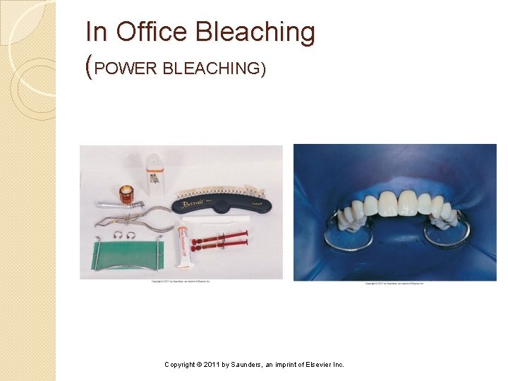 In Office Bleaching (POWER BLEACHING) Copyright © 2011 by Saunders, an imprint of Elsevier