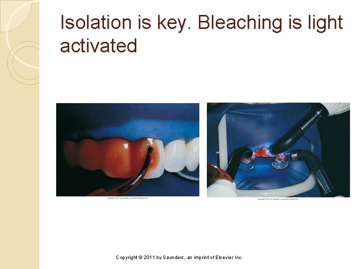 Isolation is key. Bleaching is light activated Copyright © 2011 by Saunders, an imprint