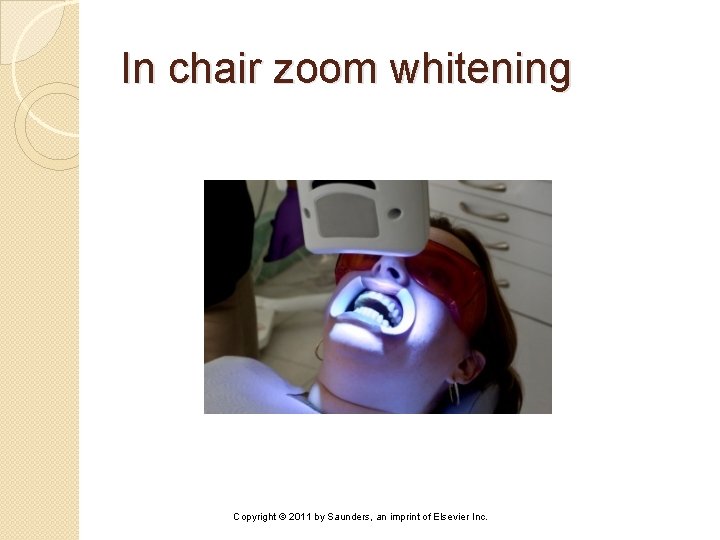 In chair zoom whitening Copyright © 2011 by Saunders, an imprint of Elsevier Inc.